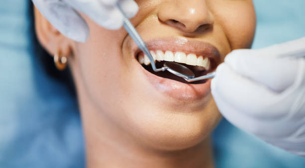 Best Emergency Broken Tooth Repair in Hideaway, TX